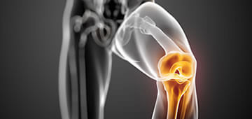 knee orthopedics in Guadalajara